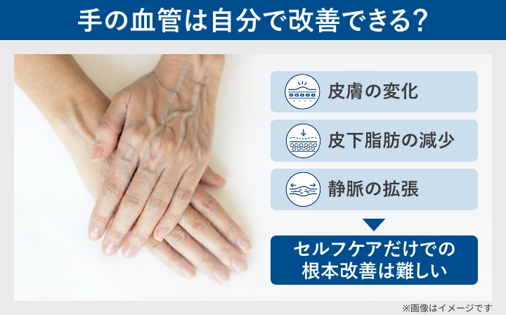 ハンドベインはセルフケアだけで根本改善が難しいことを示したイメージ図