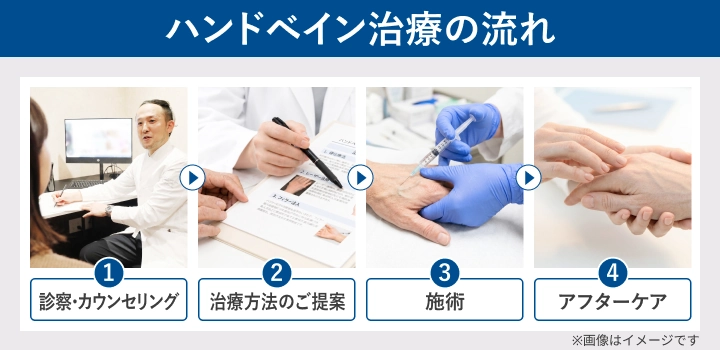 ハンドベイン治療の流れ（診察・カウンセリングからアフターケアまで）を示したフロー図