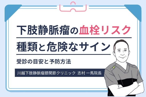 下肢静脈瘤の血栓リスクや種類、危険なサインを解説する記事のアイキャッチ画像